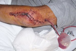 elbow_0.jpg