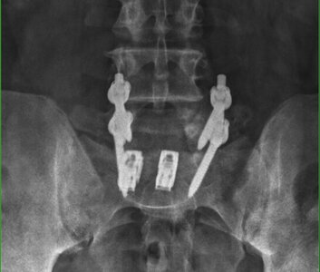 Screenshot_20241112_083759_Samsung Internet(1).jpg