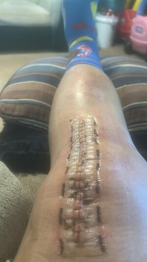 knee1.jpg