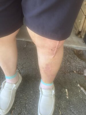 knee 2.jpg